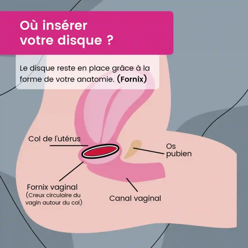 Disque menstruel Mypads + pochette de rangement – Image 4