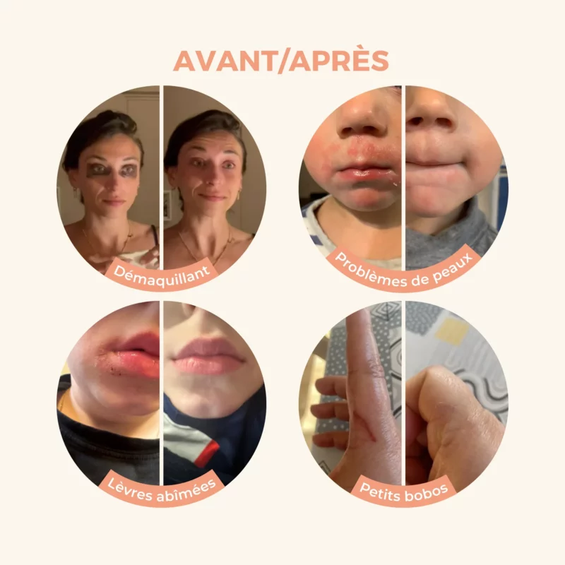 Baume Magique CBD 30ml Bio  - Les Petits Prodiges – Image 2