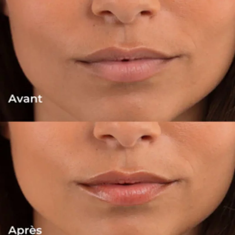 Baume lèvre teinté 10 ml - Les Petits Prodiges – Image 2
