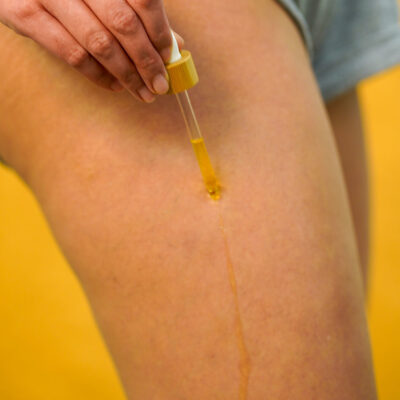 Soin anti-vergetures - Mira